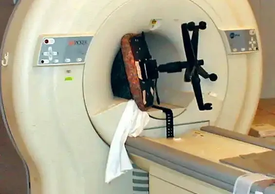 میدان مغناطیسی ایجادشده در MRI تا چه اندازه خطرناک و کشنده است؟